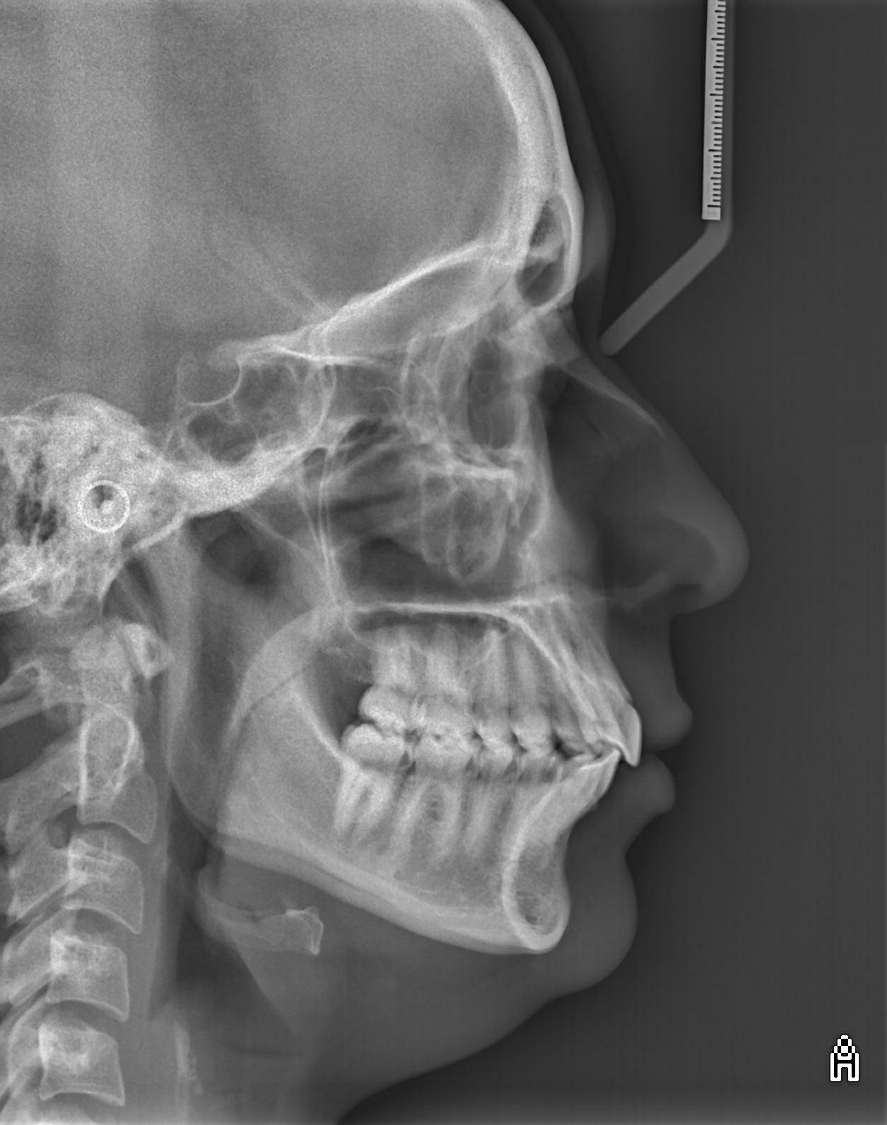 Telerradiografia Lateral